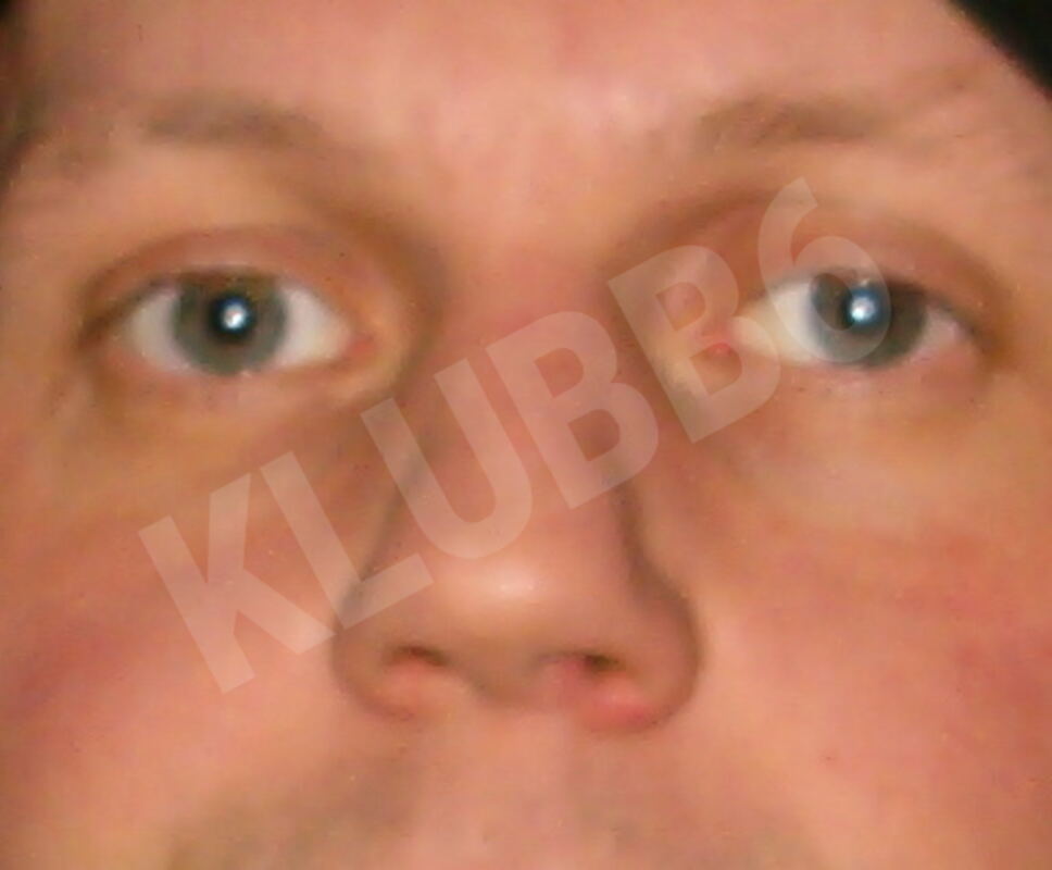 lickerman3850662