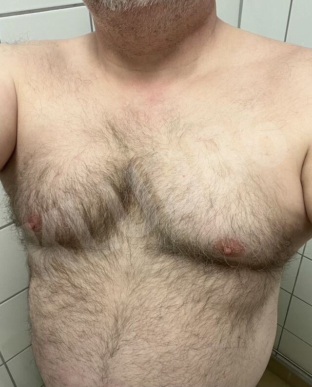 Nickebult5911849