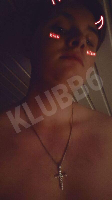 Ovve036011789
