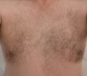 kinkymannens